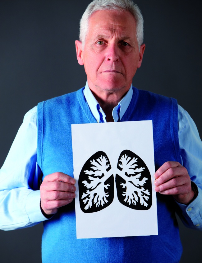 Hipertensin Pulmonar Neumosur Hipertensin Pulmonar Neumosur