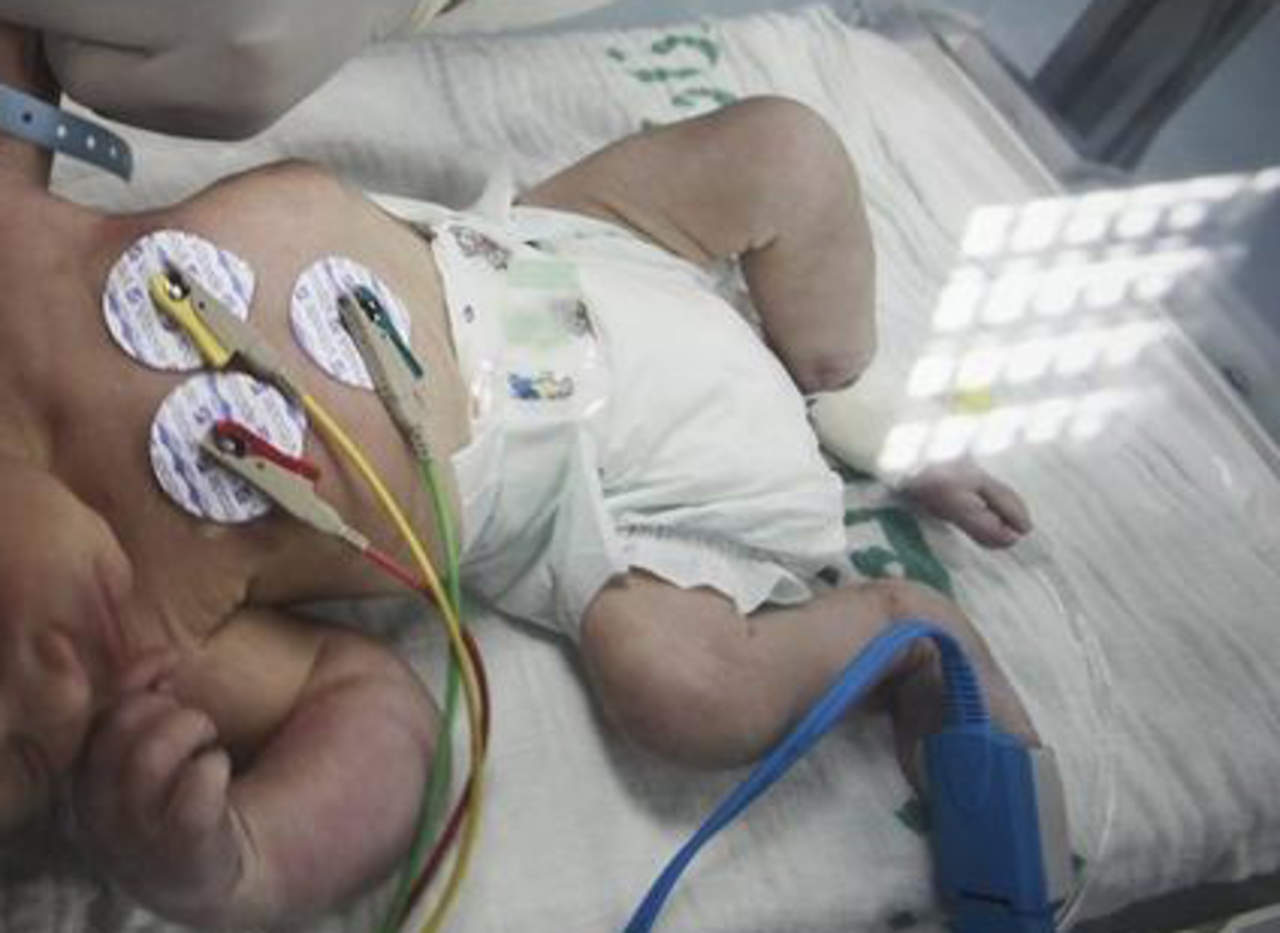 Aún es alta la tasa de mortalidad neonatal en el mundo: Unicef. Noticias en tiempo real