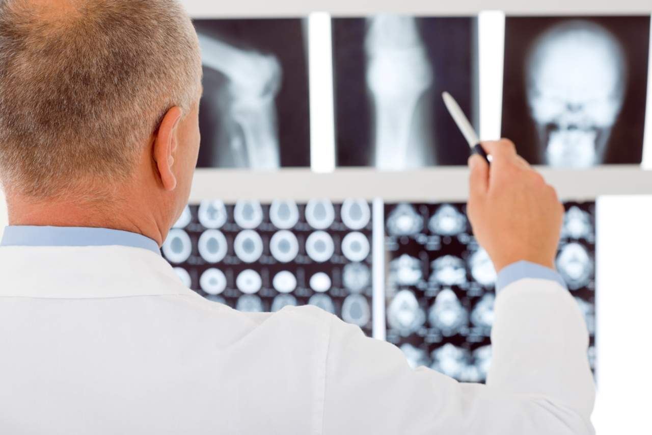 Osteoporosis, una enfermedad silenciosa. Noticias en tiempo real