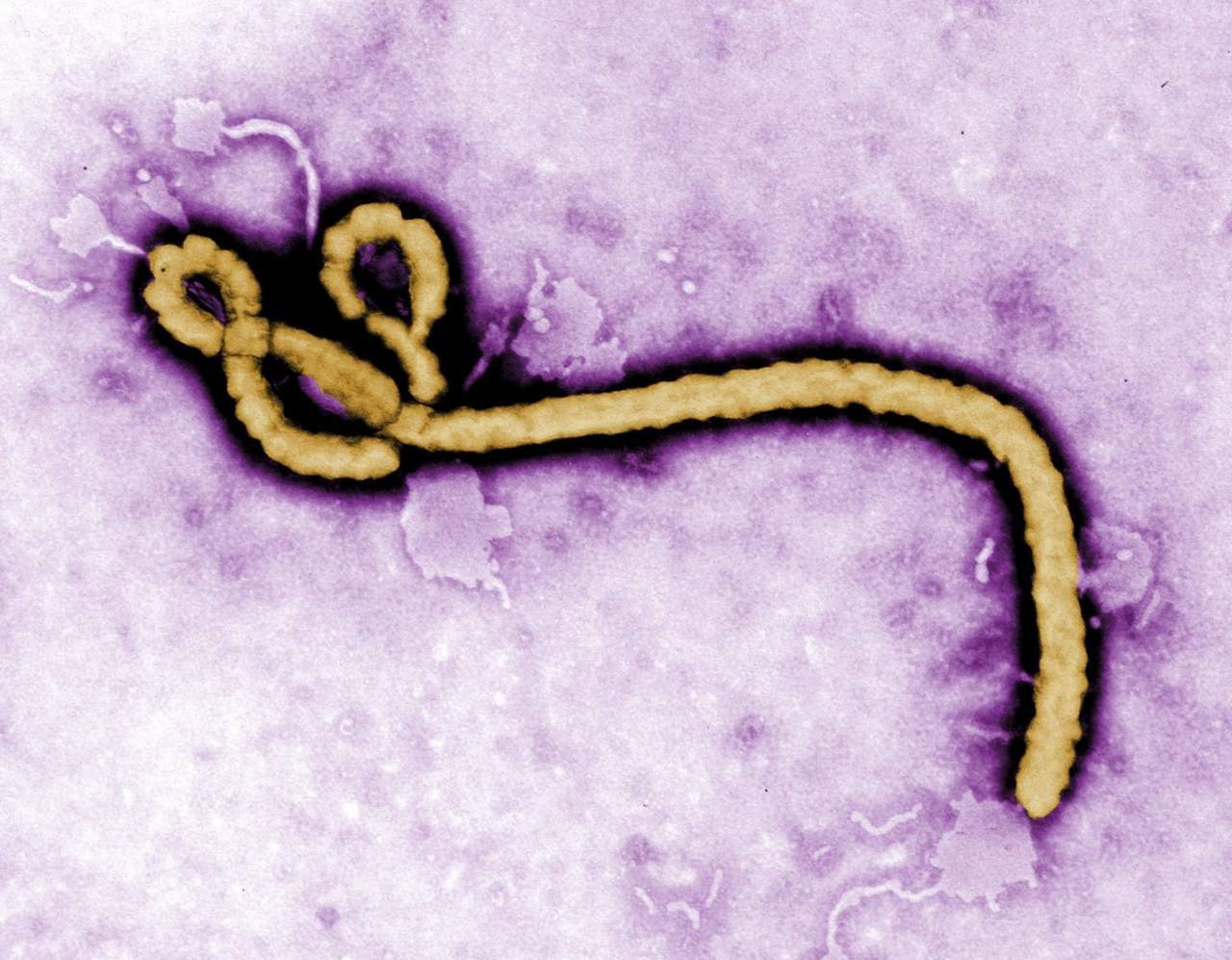 Prototipo de vacuna protege un 80% contra el ébola en ratones. Noticias en tiempo real