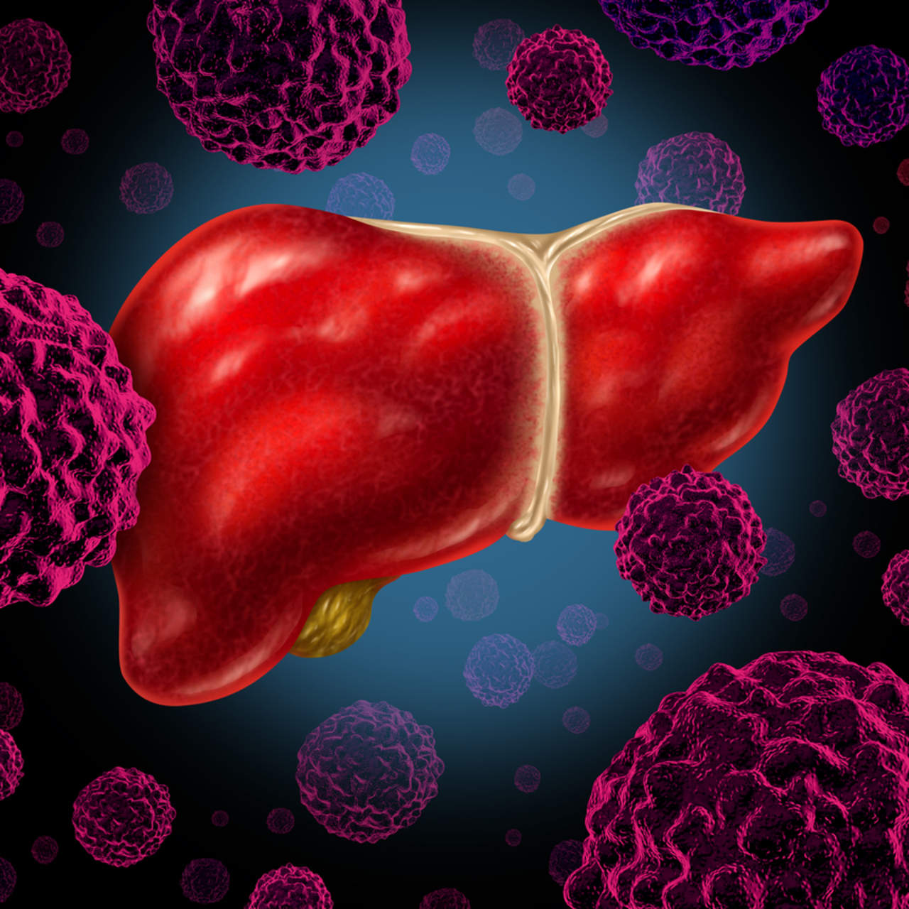 Obesidad y hepatitis aumentan incidencia de cáncer de hígado. Noticias en tiempo real