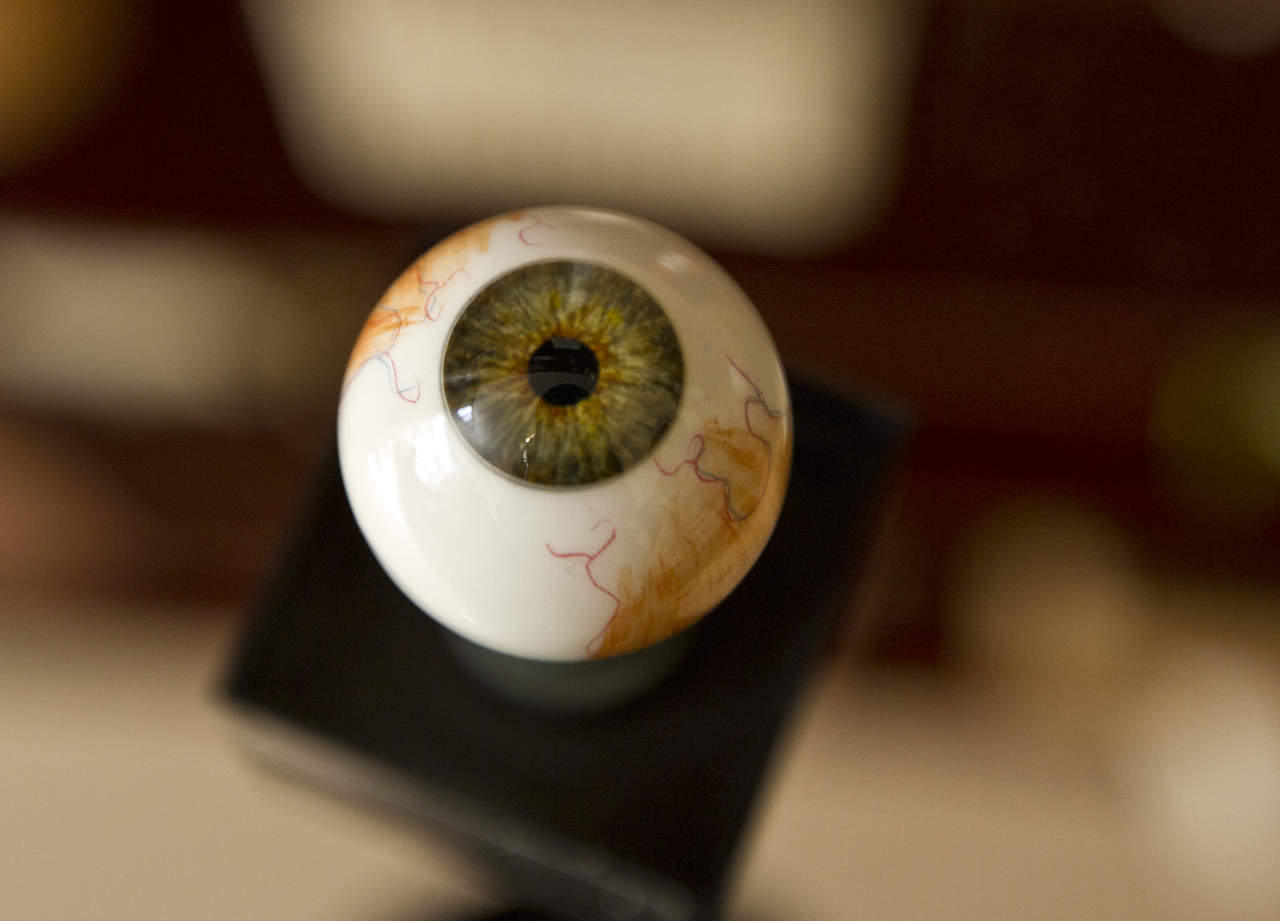 Sólo 20 por ciento de casos de glaucoma presenta síntomas, dice experto. Noticias en tiempo real
