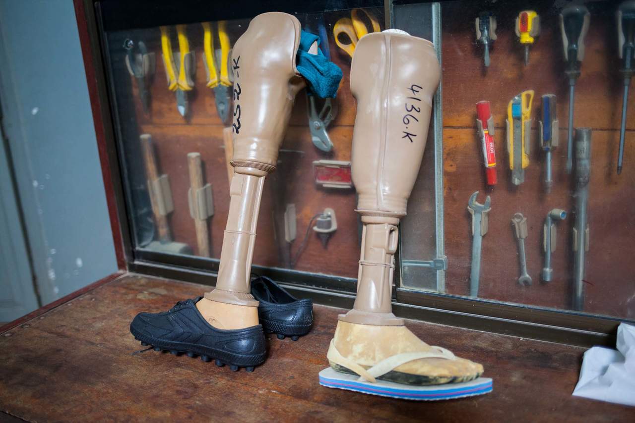 Diseñan pie protésico de bajo costo que imita la caminata natural. Noticias en tiempo real