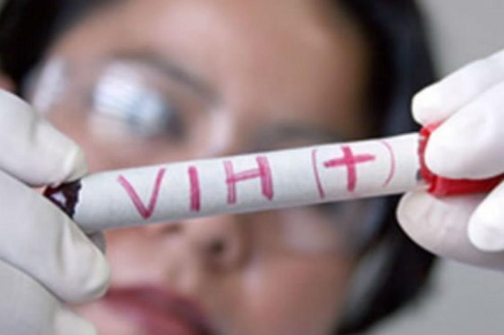 Detectan 13 casos nuevos de VIH en Gómez Palacio. Noticias en tiempo real