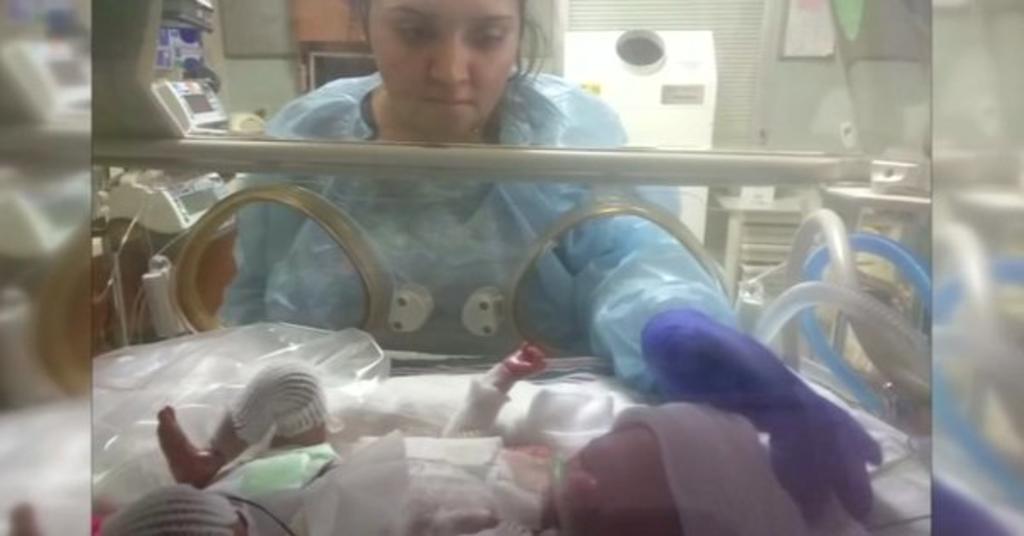 Sin diagnóstico, bebé que nació sin piel en San Antonio. Noticias en tiempo real