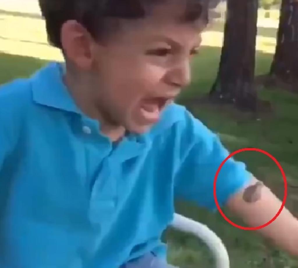 Reacción de niño se vuelve viral al saltarle una rana a su boca. Noticias en tiempo real
