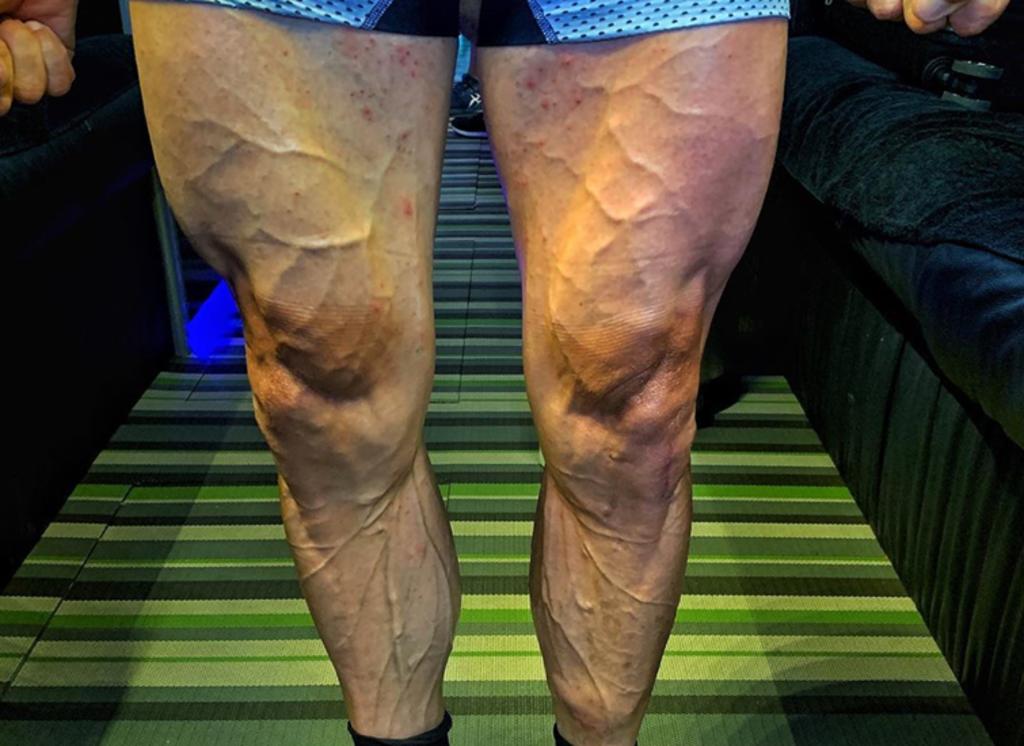 Ciclista impresiona con imagen de sus piernas tras competición. Noticias en tiempo real