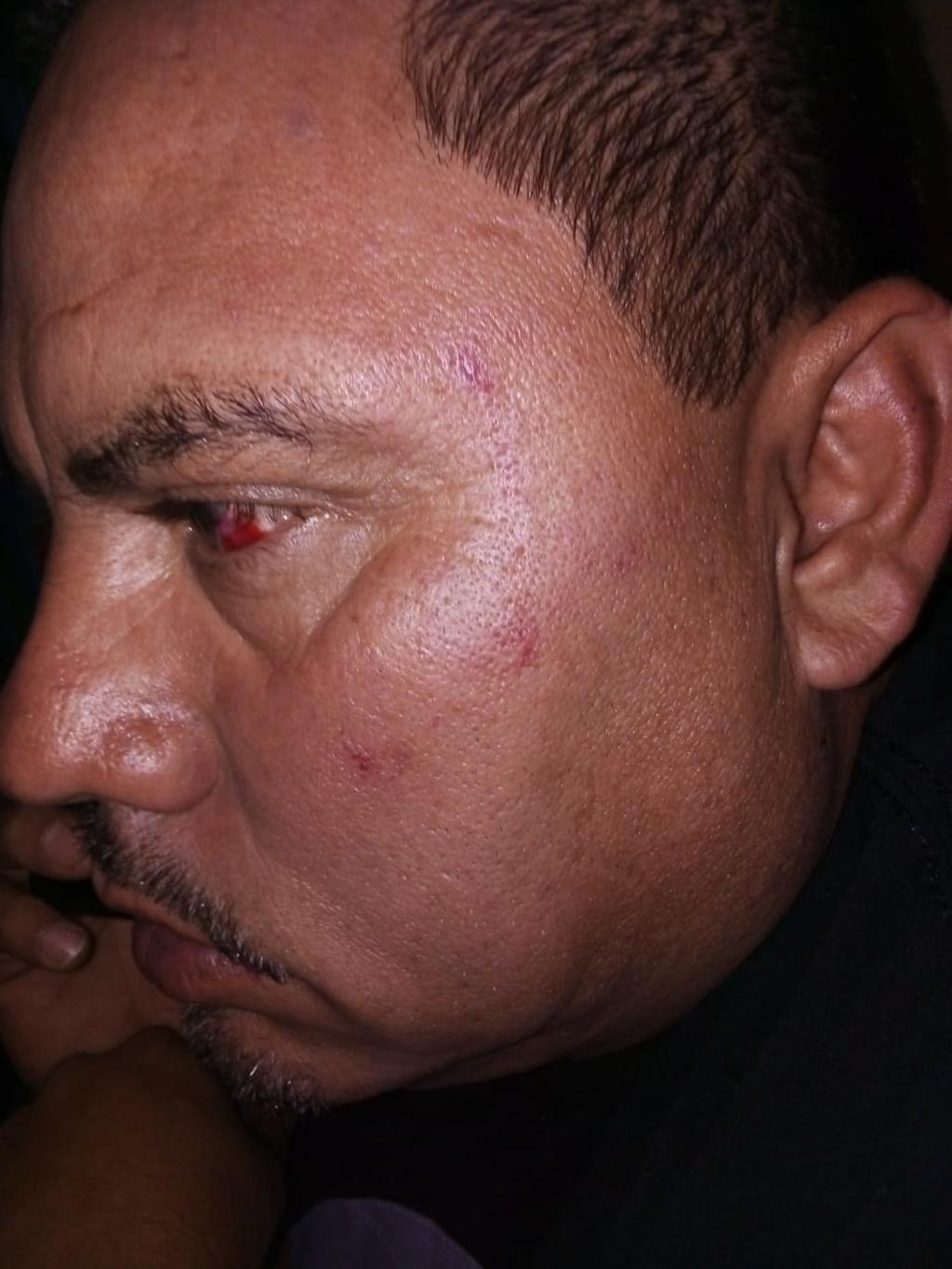 Diputado de Coahuila golpea a exdirigente panista en San Pedro y a su esposa. Noticias en tiempo real