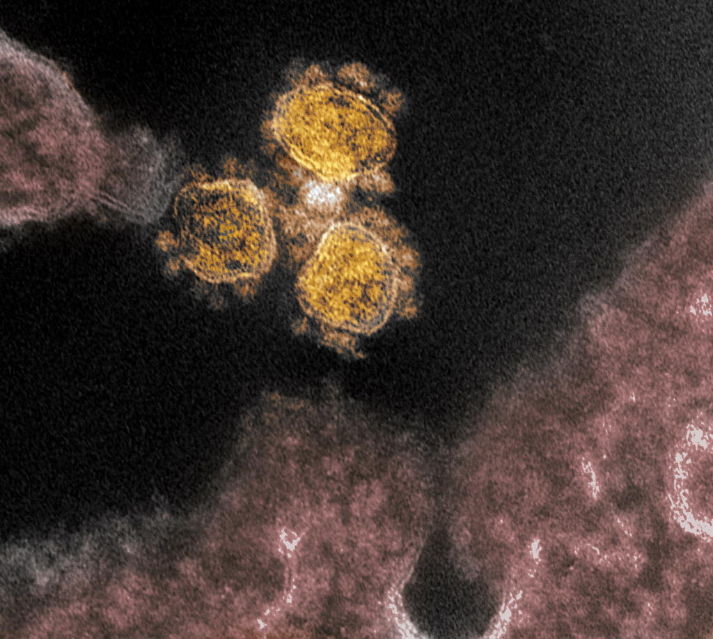 Listos 50 mil tests para coronavirus en Nuevo León. Noticias en tiempo real