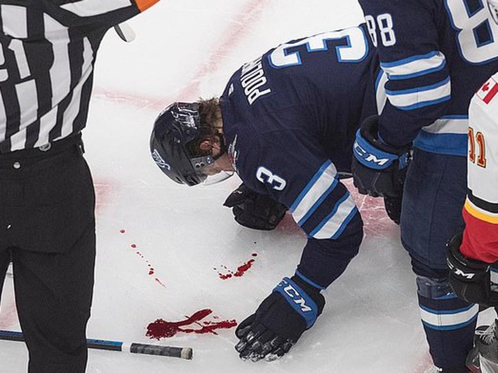 Jugador de hockey recibe un golpe en la cara y deja un rastro de sangre sobre el hielo. Noticias en tiempo real