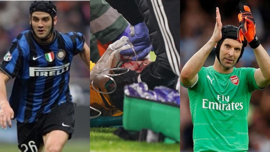 ¿Qué otros jugadores han sufrido fractura de cráneo?. Noticias en tiempo real