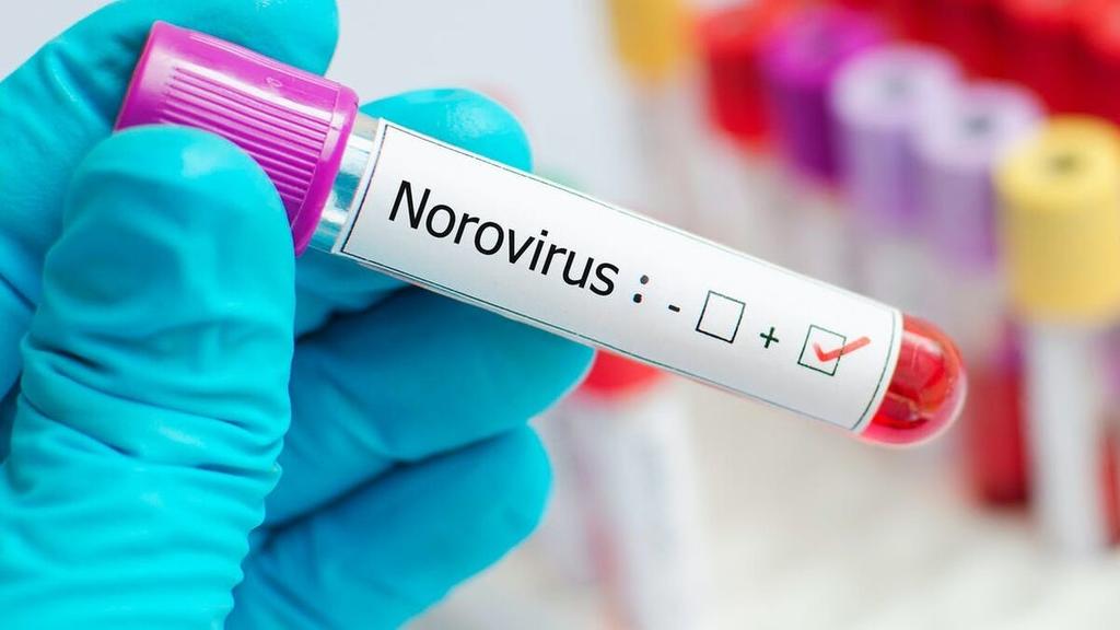¿Qué es el Norovirus? Otro virus que amenaza a China. Noticias en tiempo real