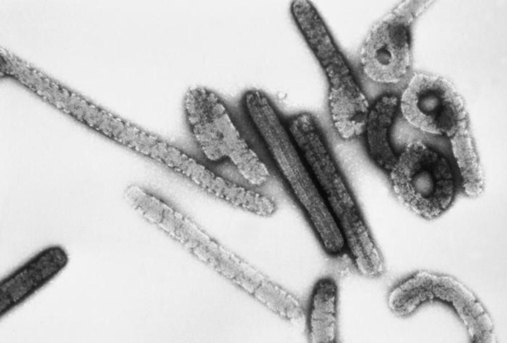 Confirman primera muerte por virus de Marburgo en África, El Siglo de  Torreón