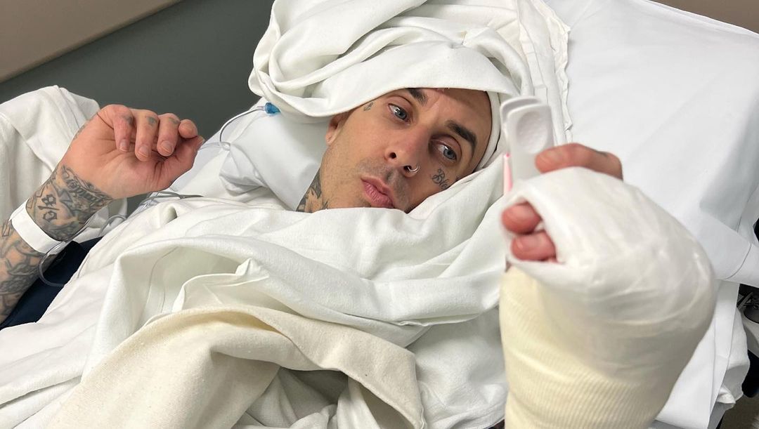 Travis Barker comparte foto de la operación en su dedo. Noticias en tiempo real
