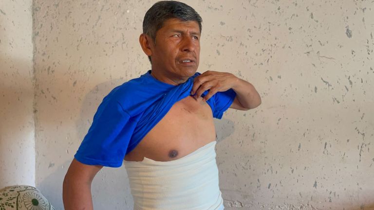 Hombre acusa de abuso policiaco a elementos municipales de Monclova. Noticias en tiempo real