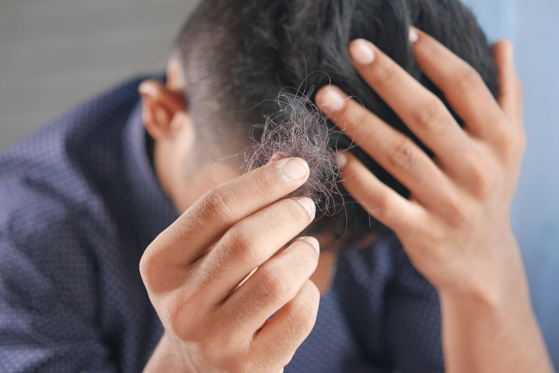 Los alimentos que aceleran la caída del cabello. Noticias en tiempo real