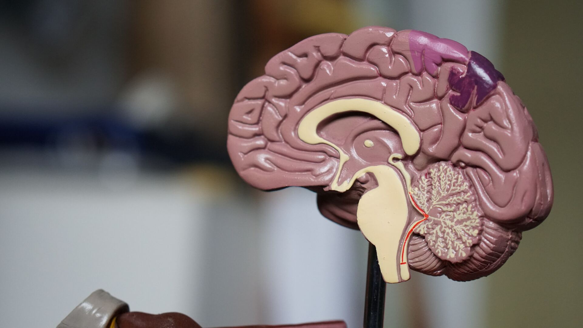 El grupo sanguíneo con más probabilidades de padecer Alzheimer. Noticias en tiempo real