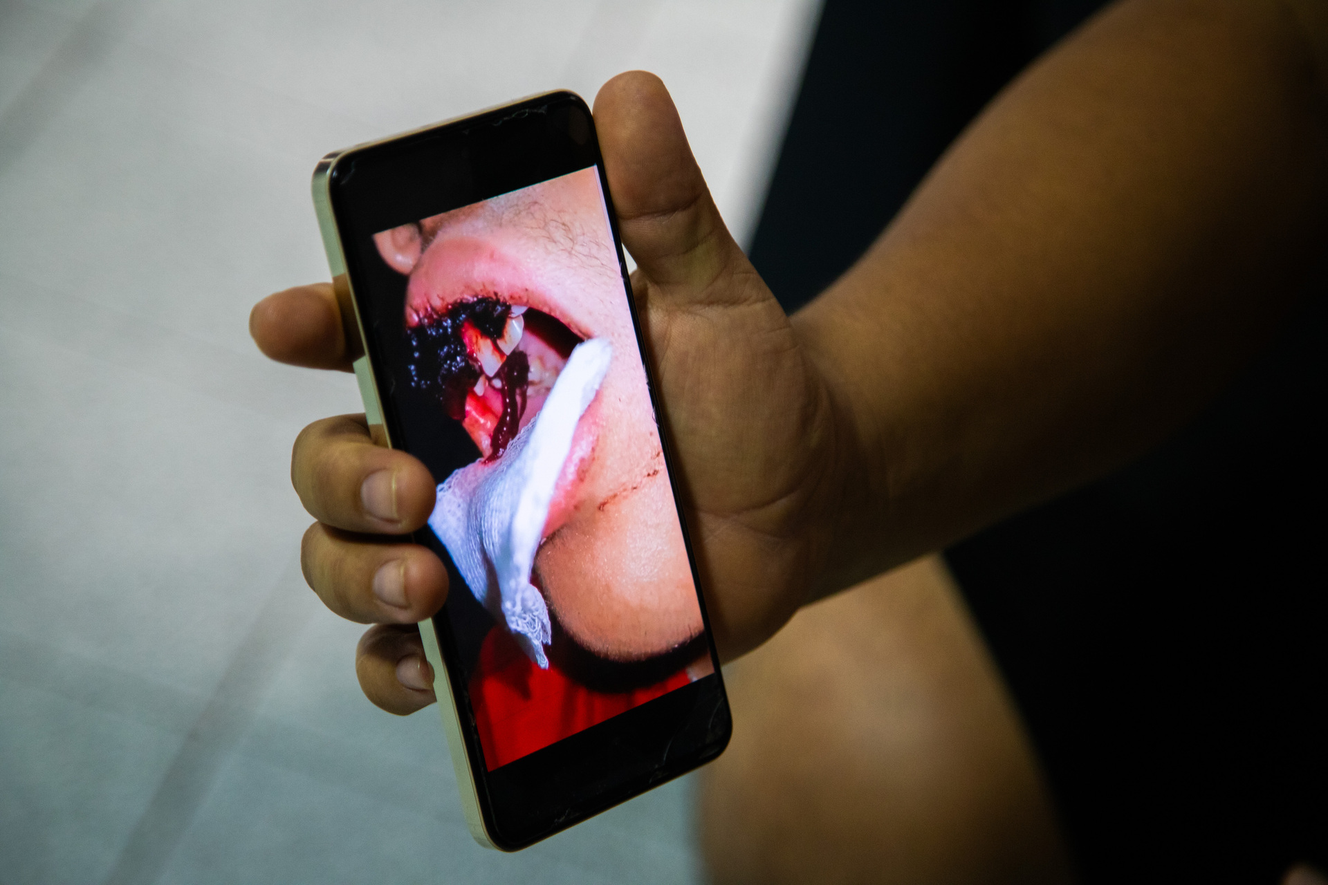 Extracción de un diente, casi le cuesta la vida a un menor de 14 años; padres buscan justicia . Noticias en tiempo real
