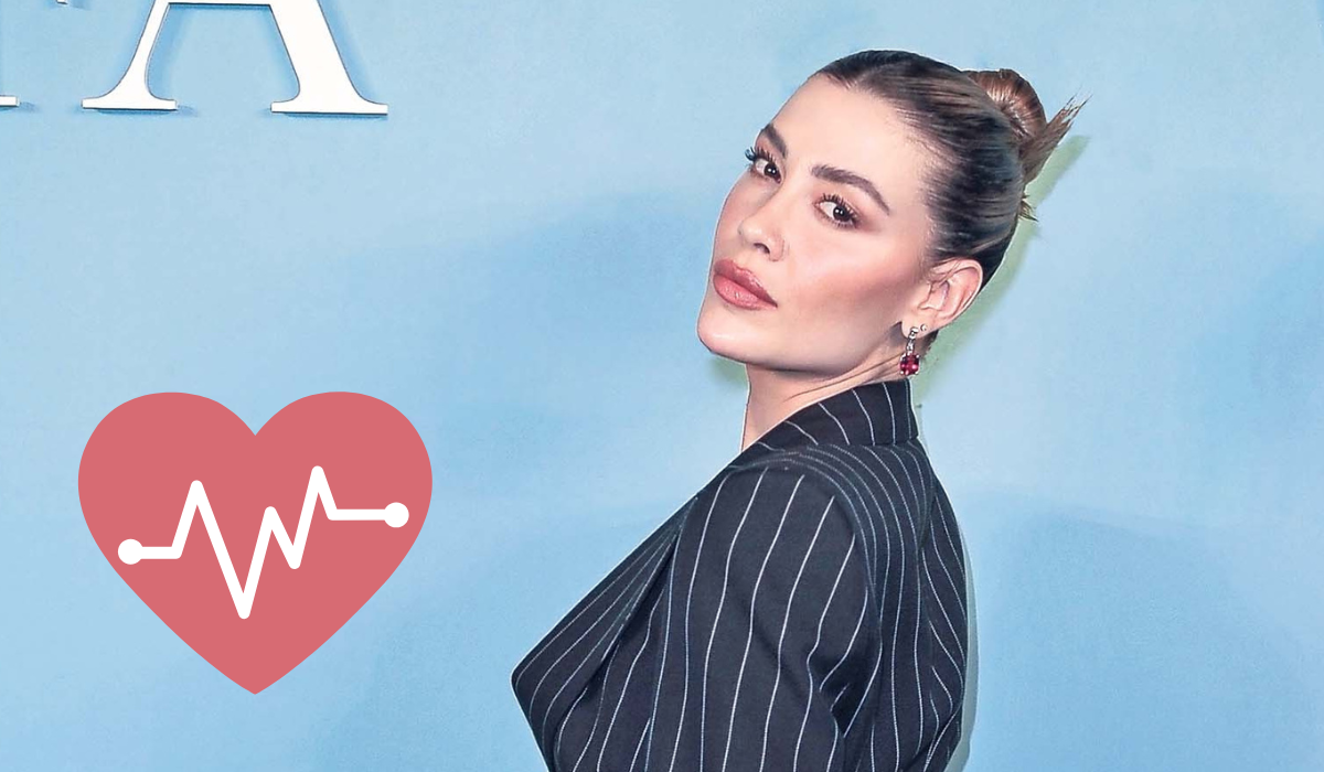 ¿Qué es el melasma, la enfermedad incurable que sufre Michelle Salas?. Noticias en tiempo real