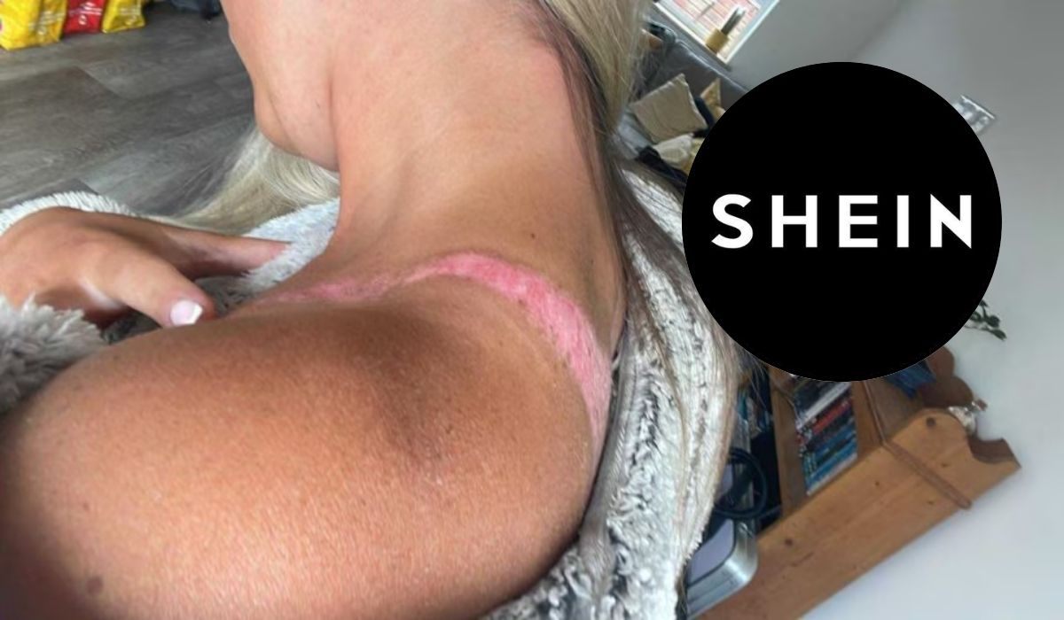 Joven sufre quemaduras tras usar un top de Shein durante sus vacaciones. Noticias en tiempo real